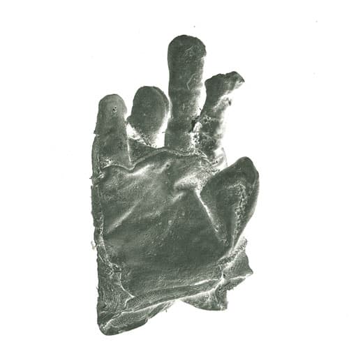 Suicide of the Hands